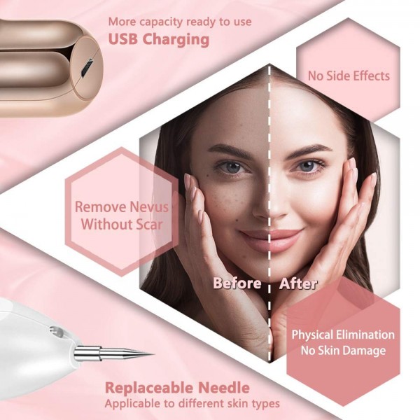  Portable Beauty Equipment Skin Tag Remover pen,Multi Speed Level Adjustable Home Usage,skin tag removal device USB Charging -Gold